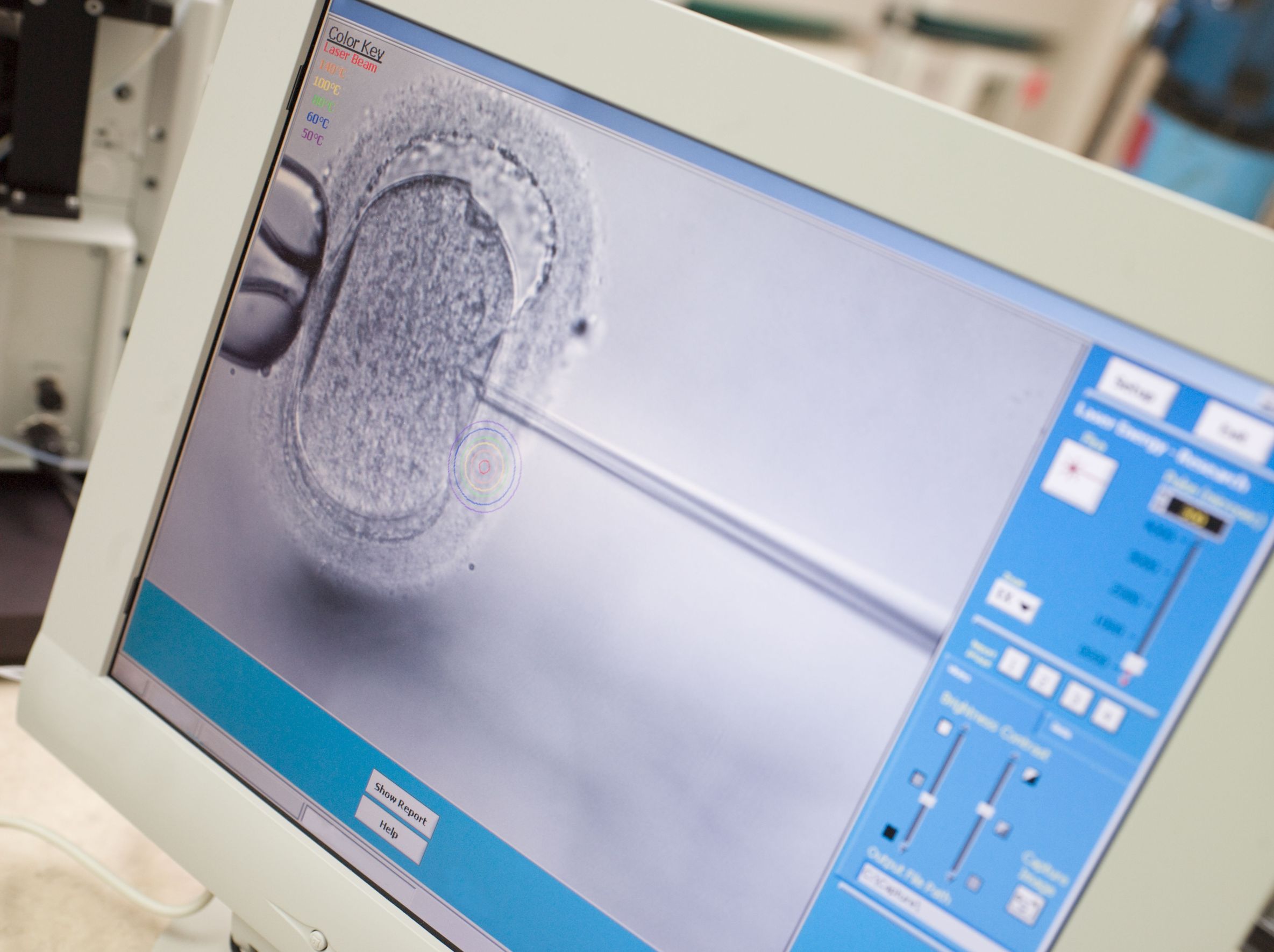 Looking for Egg Donors in Bergen County?