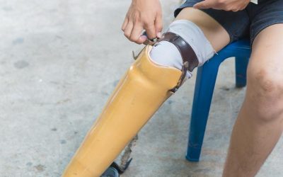Enhancing Mobility Through Joint Replacement Surgery in Louisville, KY Recovery Insights